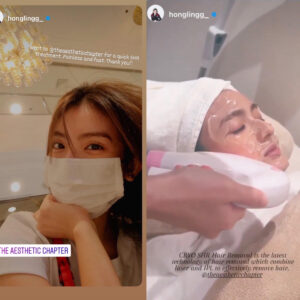 Actress @ Hong Ling (Cryo SHR Treatment)